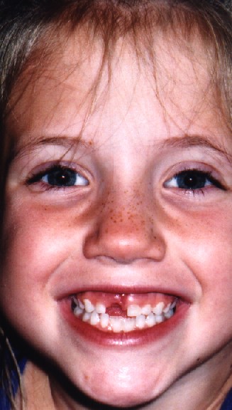 Cheeze!!  Do you like all my freckles?!?
