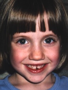 Tooth #1....